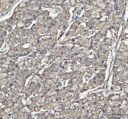 Invitrogen beta-5 Tubulin Polyclonal Antibody 100 &mu;g; Unconjugated:Antibodies,
