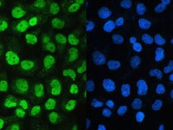 UBA2 Polyclonal Antibody:Antibodies, Polyclonal