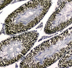 UBA2 Polyclonal Antibody:Antibodies, Polyclonal