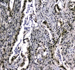 UBA2 Polyclonal Antibody:Antibodies, Polyclonal