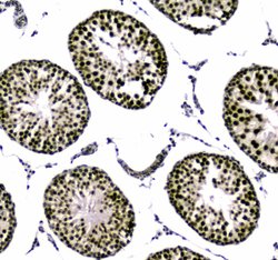 UBA2 Polyclonal Antibody:Antibodies, Polyclonal
