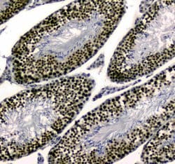 UBA2 Polyclonal Antibody:Antibodies, Polyclonal