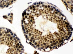Invitrogen UBA3 Polyclonal Antibody 100 &mu;g; Unconjugated:Antibodies,