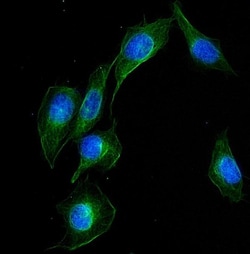 Invitrogen UBE2Q2 Polyclonal Antibody 100 &mu;g; Unconjugated:Antibodies,