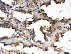 Invitrogen UBE2Q2 Polyclonal Antibody 100 &mu;g; Unconjugated:Antibodies,