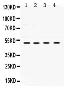 Invitrogen UBE2Q2 Polyclonal Antibody 100 &mu;g; Unconjugated:Antibodies,