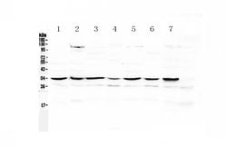 Invitrogen UCP2 Polyclonal Antibody 100 &mu;g; Unconjugated:Antibodies,