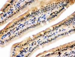 Invitrogen UHRF2 Polyclonal Antibody 100 &mu;g; Unconjugated:Antibodies,