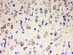 Invitrogen ULK3 Polyclonal Antibody 100 &mu;g; Unconjugated:Antibodies,