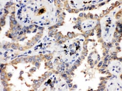 Invitrogen ULK3 Polyclonal Antibody 100 &mu;g; Unconjugated:Antibodies,