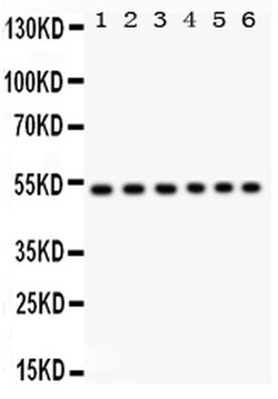 Invitrogen ULK3 Polyclonal Antibody 100 &mu;g; Unconjugated:Antibodies,