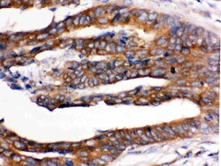 Invitrogen UPF1 Polyclonal Antibody 100 &mu;g; Unconjugated:Antibodies,