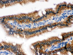 Invitrogen UPF1 Polyclonal Antibody 100 &mu;g; Unconjugated:Antibodies,