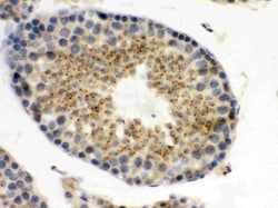 Invitrogen UPF3B Polyclonal Antibody 100 &mu;g; Unconjugated:Antibodies,