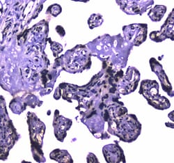 Invitrogen USP7 Polyclonal Antibody 100 &mu;g; Unconjugated:Antibodies,