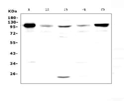 Invitrogen VCAM-1 (CD106) Polyclonal Antibody 100 &mu;g; Unconjugated:Antibodies,