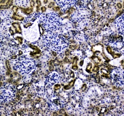 Invitrogen VCAM-1 (CD106) Polyclonal Antibody 100 &mu;g; Unconjugated:Antibodies,