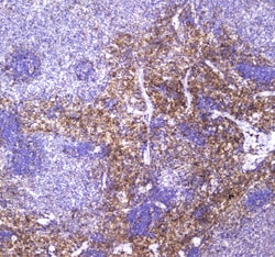 Invitrogen VCAM-1 (CD106) Polyclonal Antibody 100 &mu;g; Unconjugated:Antibodies,