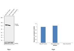 Invitrogen Vinculin Polyclonal Antibody 100 &mu;g; Unconjugated:Antibodies,