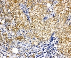 Invitrogen Vinculin Polyclonal Antibody 100 &mu;g; Unconjugated:Antibodies,