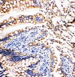Invitrogen Vinculin Polyclonal Antibody 100 &mu;g; Unconjugated:Antibodies,