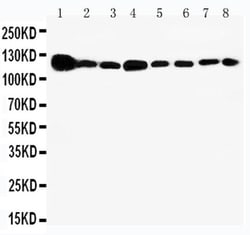 Invitrogen Vinculin Polyclonal Antibody 100 &mu;g; Unconjugated:Antibodies,