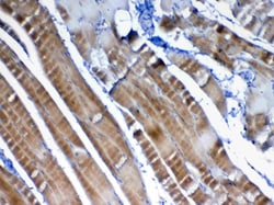 Invitrogen VEGFB Polyclonal Antibody 100 &mu;g; Unconjugated:Antibodies,