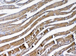 Invitrogen VEGFB Polyclonal Antibody 100 &mu;g; Unconjugated:Antibodies,