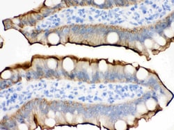 Invitrogen Villin Polyclonal Antibody 100 &mu;g; Unconjugated:Antibodies,