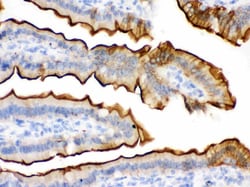 Invitrogen Villin Polyclonal Antibody 100 &mu;g; Unconjugated:Antibodies,