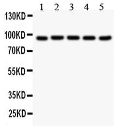 Invitrogen Villin Polyclonal Antibody 100 &mu;g; Unconjugated:Antibodies,