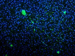 Invitrogen VWF Polyclonal Antibody 100 &mu;g; Unconjugated:Antibodies,