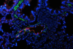 Invitrogen VWF Polyclonal Antibody 100 &mu;g; Unconjugated:Antibodies,
