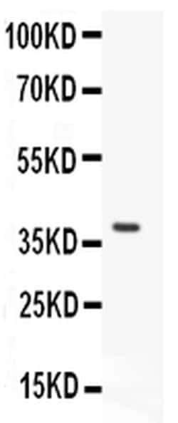 Invitrogen VWF Polyclonal Antibody 100 &mu;g; Unconjugated:Antibodies,
