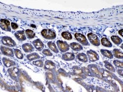 Invitrogen WFDC2 Polyclonal Antibody 100 &mu;g; Unconjugated:Antibodies,