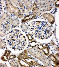 Invitrogen WISP1 Polyclonal Antibody 100 &mu;g; Unconjugated:Antibodies,