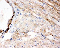 Invitrogen WISP1 Polyclonal Antibody 100 &mu;g; Unconjugated:Antibodies,