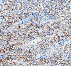 Invitrogen WISP1 Polyclonal Antibody 100 &mu;g; Unconjugated:Antibodies,