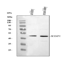 Invitrogen WISP1 Polyclonal Antibody 100 &mu;g; Unconjugated:Antibodies,