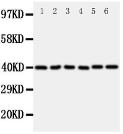 Invitrogen WISP1 Polyclonal Antibody 100 &mu;g; Unconjugated:Antibodies,