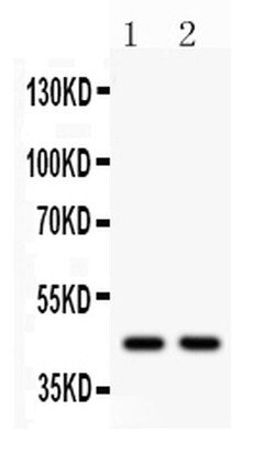 Invitrogen WNT3 Polyclonal Antibody 100 &mu;g | Buy Online | Invitrogen&trade; | Fisher Scientific