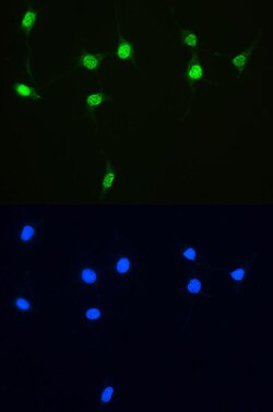 Invitrogen XRCC1 Polyclonal Antibody 100 &mu;g | Buy Online | Invitrogen&trade; | Fisher Scientific