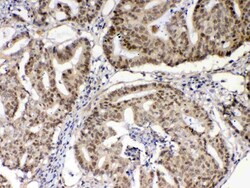 Invitrogen XRCC1 Polyclonal Antibody 100 &mu;g | Buy Online | Invitrogen&trade; | Fisher Scientific