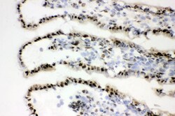 Invitrogen XRCC1 Polyclonal Antibody 100 &mu;g | Buy Online | Invitrogen&trade; | Fisher Scientific