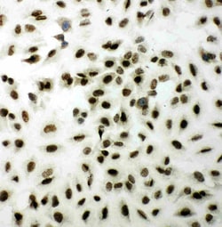 Invitrogen XRCC1 Polyclonal Antibody 100 &mu;g; Unconjugated:Antibodies,