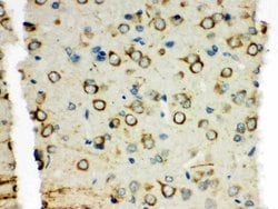 XRCC3 Polyclonal Antibody:Antibodies, Polyclonal
