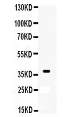 XRCC3 Polyclonal Antibody:Antibodies, Polyclonal