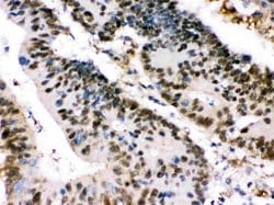 Invitrogen XRCC4 Polyclonal Antibody 100 &mu;g; Unconjugated:Antibodies,