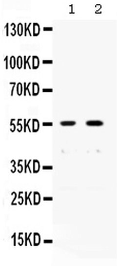 Invitrogen XRCC4 Polyclonal Antibody 100 &mu;g; Unconjugated:Antibodies,