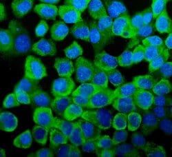 Invitrogen YBX1 Polyclonal Antibody 100 &mu;g; Unconjugated:Antibodies,